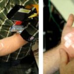 Pesquisadores criam sistema de touchscreen na pele