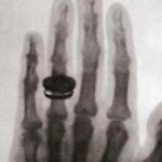 Noções Básicas de Raios X